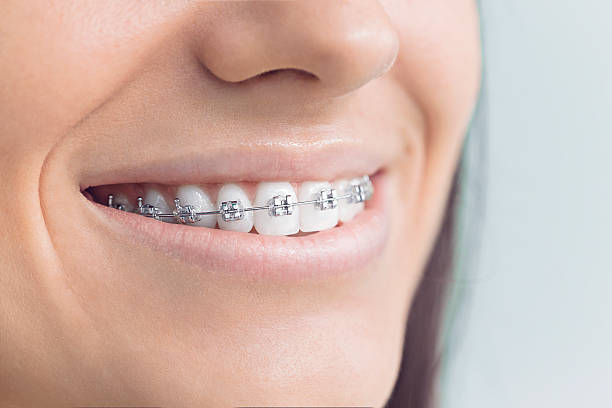 Full Mouth Reconstruction in Applewood, CO